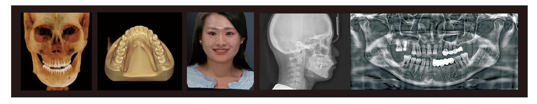 Fussen Rubik images1