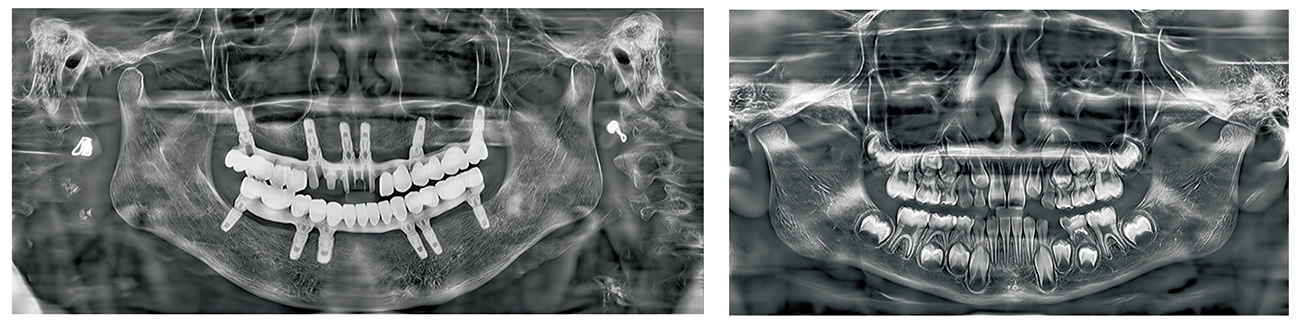 Fussen Rubik images3