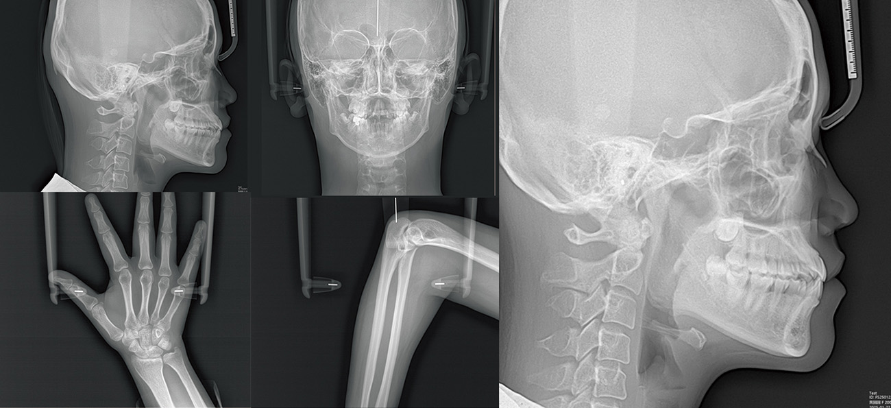 Fussen Rubik images4