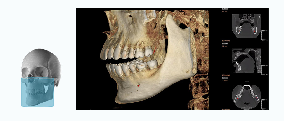 Fussen Rubik images6 12 10