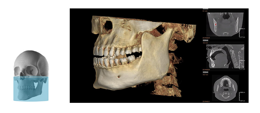 Fussen Rubik images6 16 10