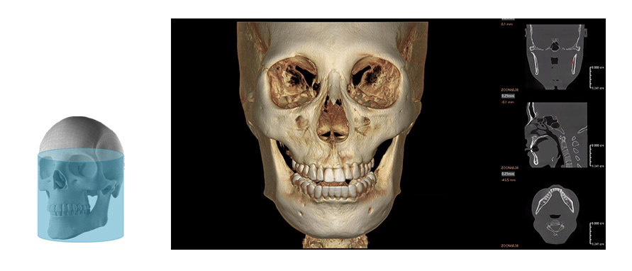 Fussen Rubik images6 16 16