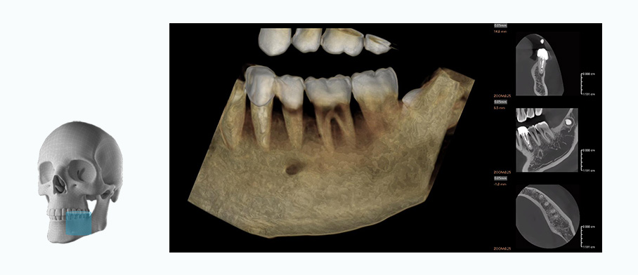 Fussen Rubik images6 5 5