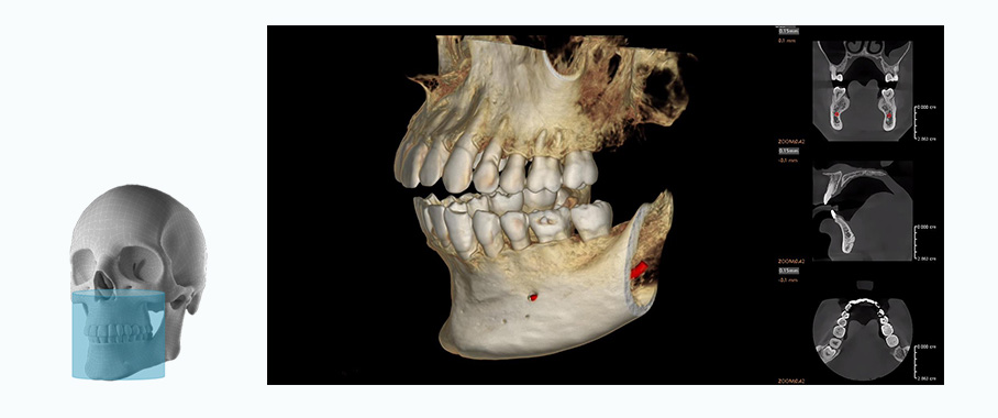 Fussen Rubik images6 9 9