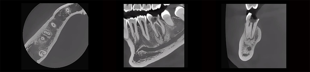 Fussen Rubik images7