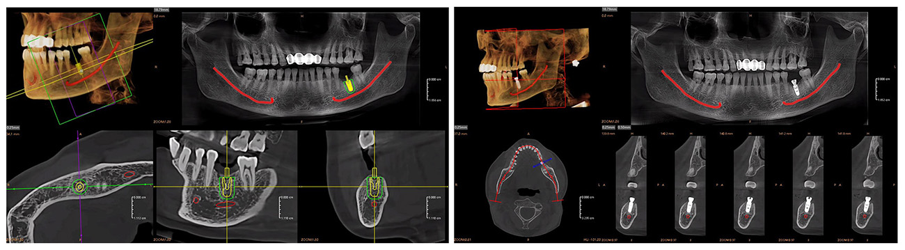 Fussen Rubik images8