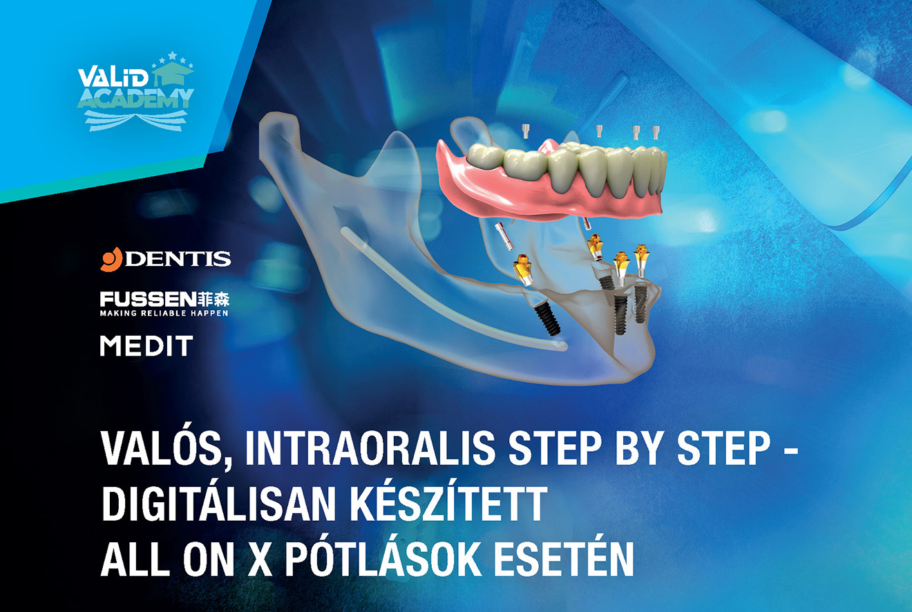 VaLiD Academy Implant kurzus 2026 05 22 header