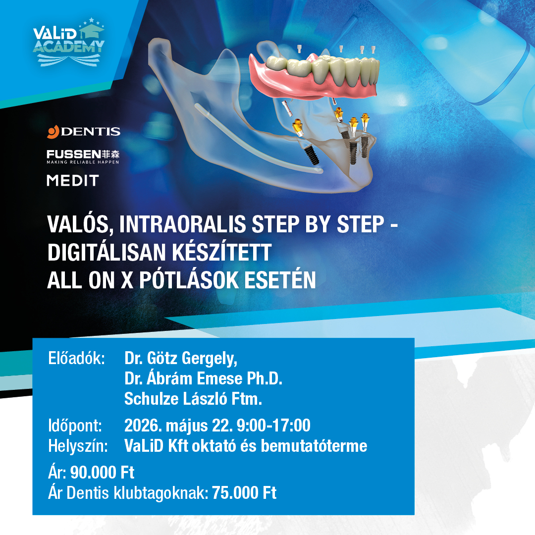 VaLiD-Academy: Digitálisan készített All-On-X protetika