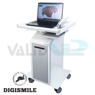 DIGISMILE Digitális Intraorál scanner ÁLLOMÁS laptoppal
